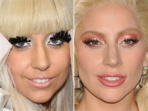 lady gaga surgery|Lady Gagas changing face: How Oscar winner retains her。